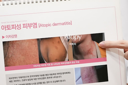 생기한의원으로 보는 아토피와 지루성피부염의 구분 포인트
